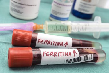 Ferritin Overload: A Dangerous Condition to Watch For