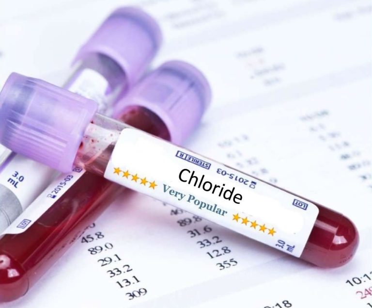 High Chloride in Blood: A blood sample tube labeled "Chloride" used for testing high chloride levels in the blood, related to hyperchloremia, dehydration, kidney issues, and electrolyte imbalance.