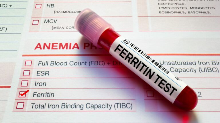 Ferritin Level Below 10 ng/mL: Ferritin blood test showing low iron stores — understanding ferritin levels, and how it affects energy and health.