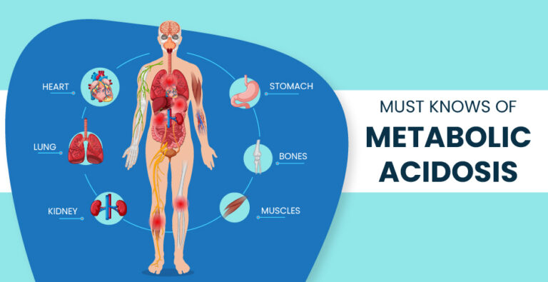 What is hyperchloremia acidosis: Know the key facts about metabolic acidosis including hyperchloremic acidosis causes, symptoms, and management explained.