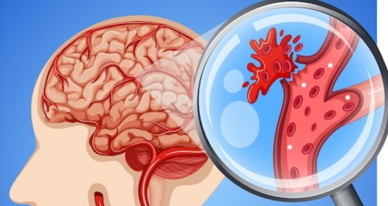 Illustration showing autoregulation of cerebral blood flow, with brain blood vessels adjusting diameter to maintain stable cerebral circulation despite blood pressure changes.